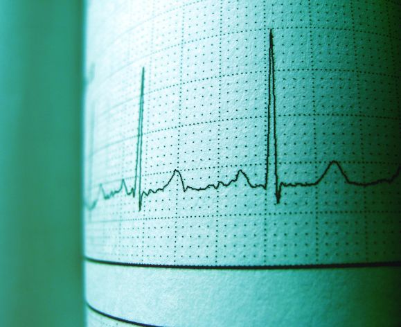 ECG screen